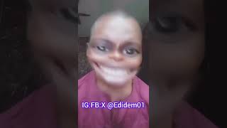 show me way she dey this evening tèéth go surplus edidem01 fyp viral subcribe [upl. by Ecneitap]