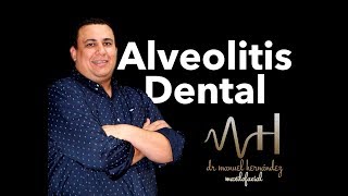 ¿Cómo evitar la alveolitis dental [upl. by Nagoh112]