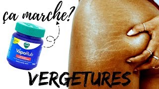 VERGETURES LA VÉRITÉ SUR LE VICKS VAPORUB [upl. by Asseret50]