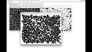 FIJI for Quantification Cell Segmentation [upl. by Ching]