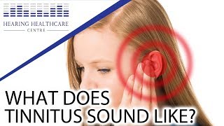 What Does Tinnitus Sound Like [upl. by Frederich864]