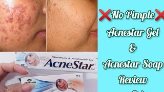 Acnestar Gel amp Acnestar Soap Review in தமிழ்👍How to remove acne pimple blackspotsSideeffects [upl. by Kelsey169]