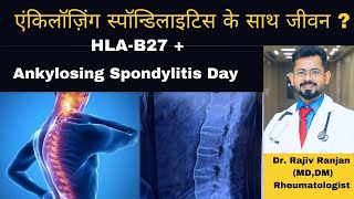 एंकिलॉज़िंग स्पॉन्डिलाइटिस के साथ कैसे जिये  । Life with Ankylosing Spondylitis [upl. by Conlen]