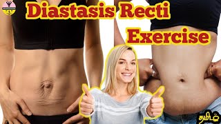 Diastasis recti exercise in tamil தமிழ் weightloss diastasisrecti pregnancyexercise [upl. by Anahc233]