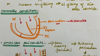 What is septal bounce signits mechanismassociations and causesMEDICINE with DR Shamama [upl. by Harobed150]