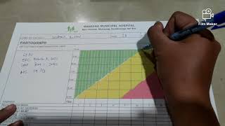 HOW TO PARTOGRAPH  LABOR MONITORING [upl. by Hyman]