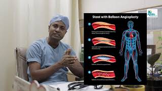 what is coronary AngioplastySraboniDasshorts youtube viralvideo health heartattack [upl. by Caldwell429]