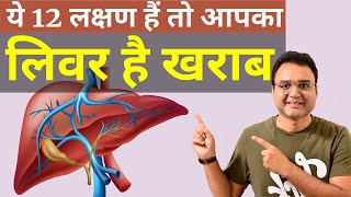 लिवर खराब होने के 12 शुरूआती लक्षण  Symptoms Of Liver Damage  by Dr Saleem Zaidi [upl. by Betti]