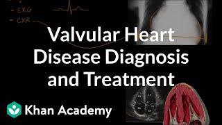 Valvular heart disease diagnosis and treatment  NCLEXRN  Khan Academy [upl. by Anomer]