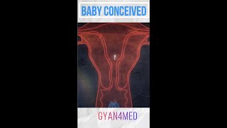 Fertilization How is a baby conceived [upl. by Dedrick995]