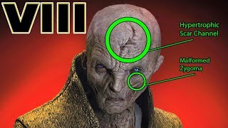 Snokes INJURIES and SCARS Explained  Star Wars The Last Jedi Explained [upl. by Burrus]