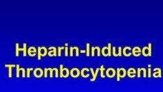 HEPARIN INDUCED THROMBOCYTOPENIA  HIT medical learnings  practical learnings [upl. by Amhser]