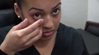 How to Apply Ointment to the Eyes and Eyelids [upl. by Lewert]