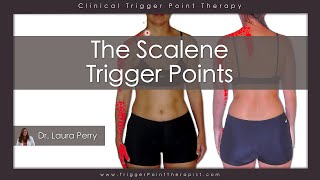 The Scalene Trigger Points [upl. by Kavanaugh704]