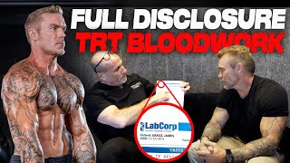 My TRT  Testosterone Protocol Reviewed by Doctor Free Testosterone SHBG DHT Estradiol amp More… [upl. by Eenat336]