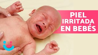 ¿Cómo CURAR un SARPULLIDO a mi BEBÉ 🤱🏻🧼 Remedios Caseros [upl. by Margarethe]