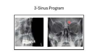 advances in panoramic radiography [upl. by Petuu899]