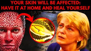 MEDJUGORJE TODAY WARNING ABOUT A PLAGUE THAT WILL AFFECT YOUR SKIN FIND OUT MORE [upl. by Nodyroc]