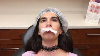 Lip Augmentation by Dr Valaie MD  Cosmetic Surgeon at Newport Beach Orange County CA [upl. by Bortz28]