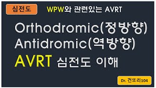 orthodromic정방향antidromic역방향 AVRT 심전도ECG 이해 [upl. by Evetta]