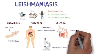 What is Leishmaniasis An introduction and overview [upl. by Allecnirp]