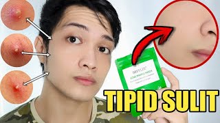 HOW TO GET RID OF PIMPLES OVERNIGHT  BREYLEE ACNE PIMPLE PATCH  CEBU Philippines [upl. by Verdi]