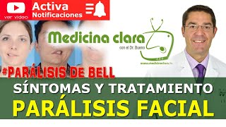 Parálisis facial periférica Parálisis de Bell Bell´s Palsy ¿Qué es exactamente  Medicina Clara [upl. by Albric]