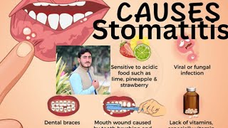 Stomatitis Chapter1 Disease1 AHN 3rd semester kmu slides in pashto drnajeebnote drnajeeb kmupdat [upl. by Odysseus]