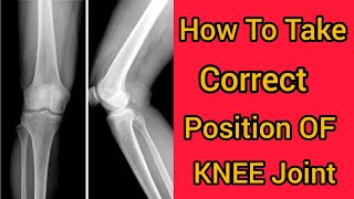 Knee Joint Xray Positioning Ap  Lateral View  Radiology [upl. by Anglo]