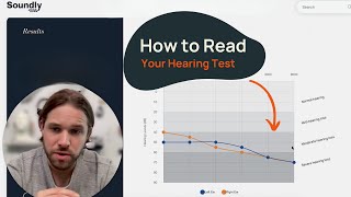 How to Read a Hearing Test  Common Configurations [upl. by Annasus]