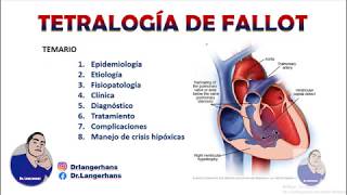 TETRALOGÍA DE FALLOT CARDIOPATÍAS CONGÉNITAS [upl. by Yacov]