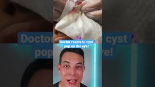 Crazy huge pop on this eyelid cyst  208SkinDoc [upl. by Yrailih]