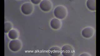 Blood Plasma  Bacterial Rod [upl. by Amehr]