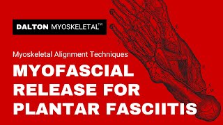 Use These Deep Tissue Myofascial Release Techniques for Plantar Fasciitis Treatment [upl. by Klein]