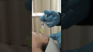 Exosome Skin Rejuvenation Treatment exosomes acnescars antiaging finelinesandwrinkles collagen [upl. by Toogood]