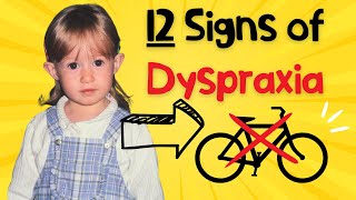 Could you actually have Dyspraxia DCD [upl. by Riggins]