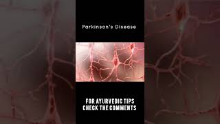 Parkinsons Disease Is Curable shorts ayurveda [upl. by Carce]