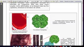 1ère Spé SVT Tp1Ch1 Etude dune maladie monogénique  La drépanocytose [upl. by Anaicilef666]