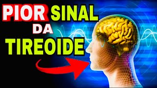 7 SINAIS PERIGOSOS do HIPERTIREOIDISMO Sintomas da Tireoide Produzindo Muitos Hormônios T3 e T4 [upl. by Anyahc]