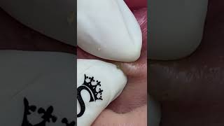 Viền môi pimple sacdepspa relaxing [upl. by Nevar]