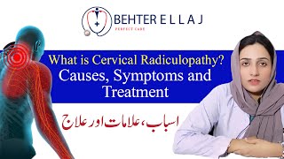 What is Cervical radiculopathy Causes Symptoms and Treatment [upl. by Rma]