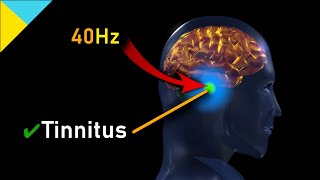 Tinnitus quotMIRACLEquot Quantum Healing Frequency HAS ARRIVED 40Hz • Gamma Waves [upl. by Oflunra445]