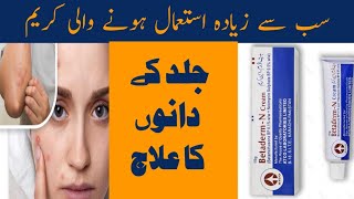 Betaderm N Cream uses in Urdu  Acne Cream Review [upl. by Stauder]