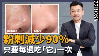 粉刺清不掉？痘痘一直長？吃『它』超有效，大幅降低粉刺發生率！【77老大】 [upl. by Orferd280]