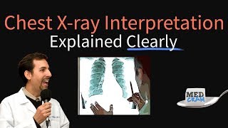 Chest XRay Interpretation Explained Clearly  How to read a CXR [upl. by Haidabez853]