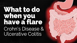 What to do if you have a Crohns disease or ulcerative colitis flare  GI Society [upl. by Sproul46]