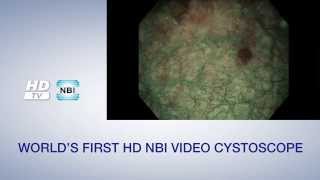 Olympus NBI Urology Video  English Version [upl. by Callie]