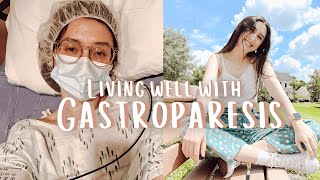 how i live well with gastroparesis  10 things that have helped me cope with my chronic illness [upl. by Frymire603]