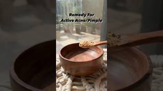 How to get rid of Acne  Acne treatment at home  pimples removal on face at home  short skincare [upl. by Towney876]