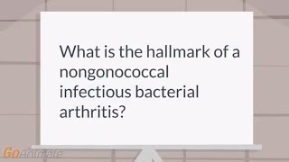 Symptoms of a nongonococcal bacterial arthritis [upl. by Jessi]